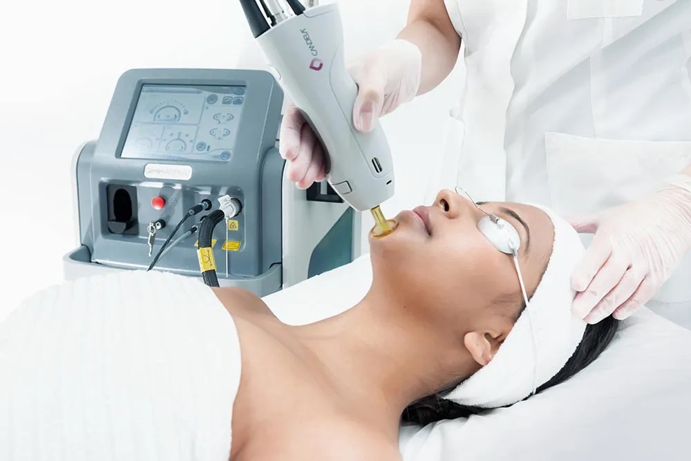 Medizinische Laser-Haarentfernung an den Beinen in der Fachpraxis Warendorf