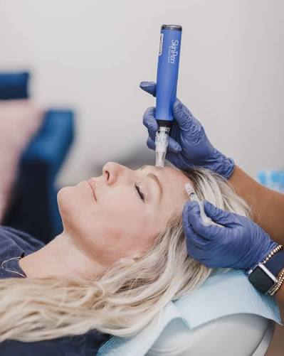 SkinPen sterile single-use needle cartridge for maximum patient safety